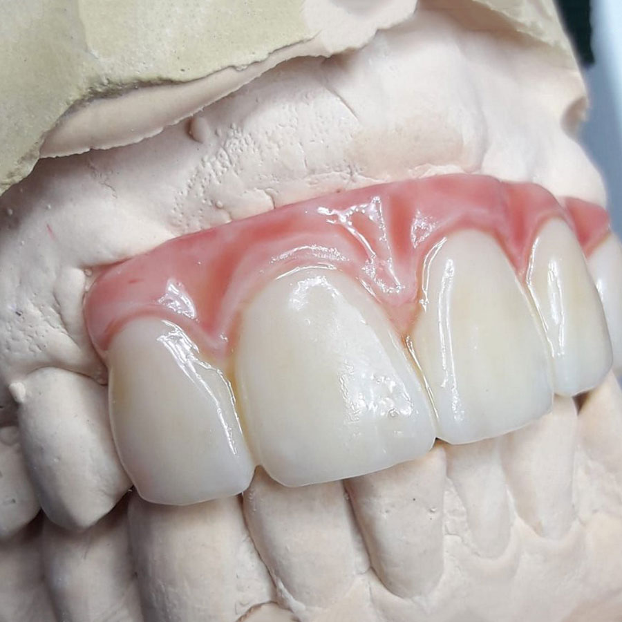 Kit de Tintes Dentales Cosmos Creation Yller - Imagen 2