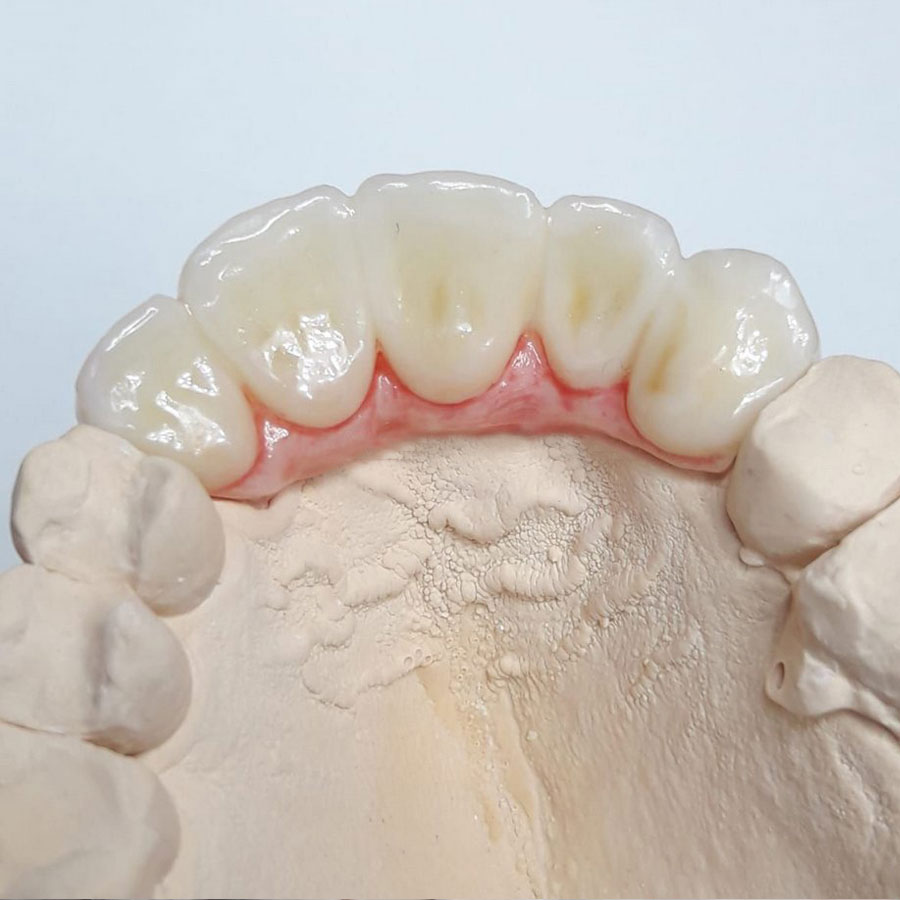 Kit de Tintes Dentales Cosmos Creation Yller - Imagen 3