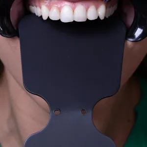 CONTRASTES PARA FOTOGRAFIA INDUSBELLO - Imagen 3